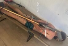 صورة لمعتقل فلسطيني تعزز الاتهامات بوقوع انتهاكات داخل مراكز الاحتجاز الإسرائيلية