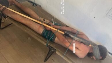 صورة لمعتقل فلسطيني تعزز الاتهامات بوقوع انتهاكات داخل مراكز الاحتجاز الإسرائيلية