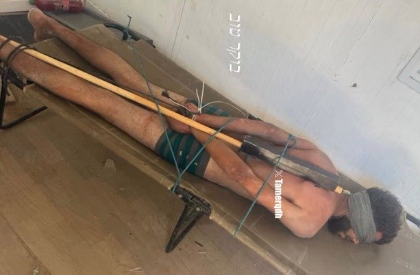 صورة لمعتقل فلسطيني تعزز الاتهامات بوقوع انتهاكات داخل مراكز الاحتجاز الإسرائيلية