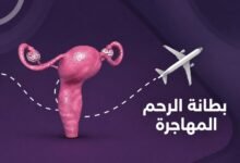 بطانة الرحم المهاجرة.