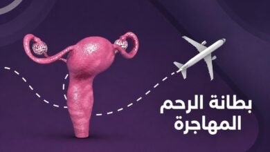 بطانة الرحم المهاجرة.