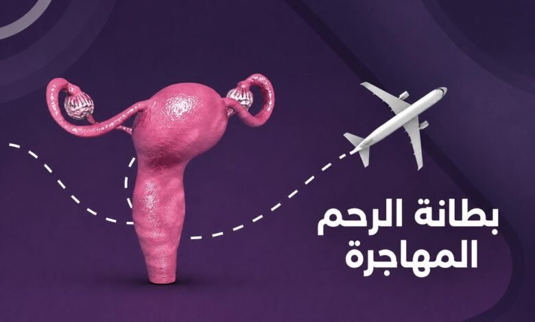 بطانة الرحم المهاجرة.