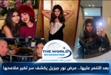 بعد التنمر عليها.. مرض نور جيزيل يكشف سر تغير ملامحها