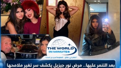 بعد التنمر عليها.. مرض نور جيزيل يكشف سر تغير ملامحها
